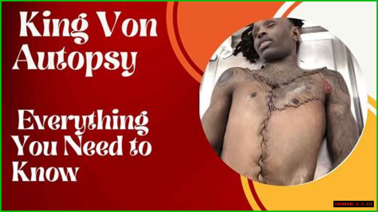 King Von's Autopsy Report: Uncovering The Final Moments